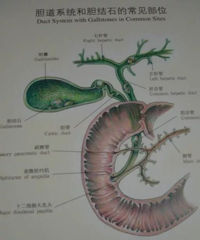 胆结石手术费用解析：一次性解决一切疑问