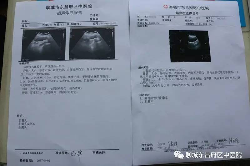 胆结石手术：了解最新疗法与术前术后注意事项