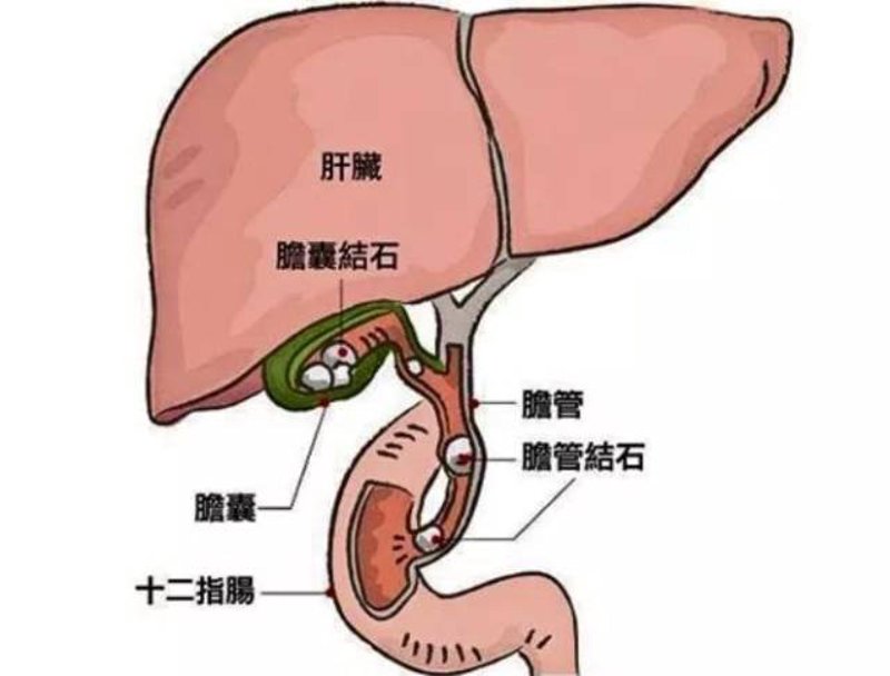保肾取石的费用解析：怎样科学合理地进行经济规划？